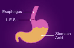 Normal digestion