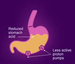 After Omeprazole ODT